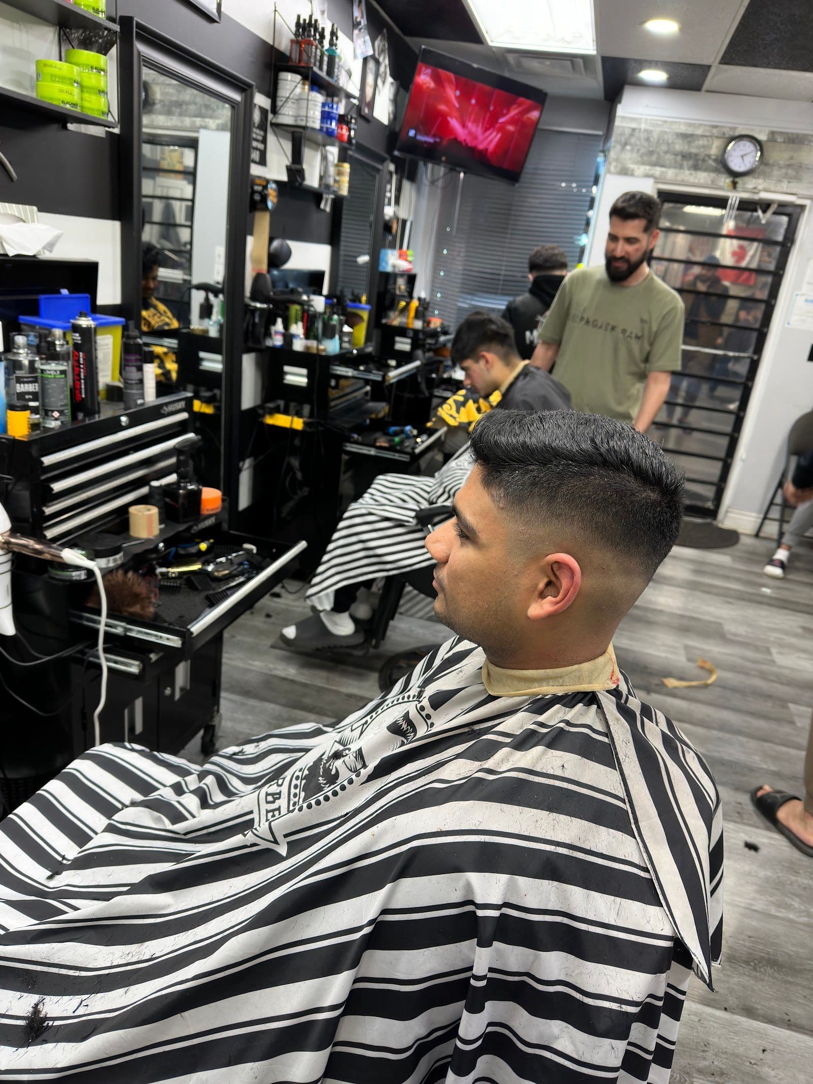 Another patient photo from a Google review at Milano Barber Shop