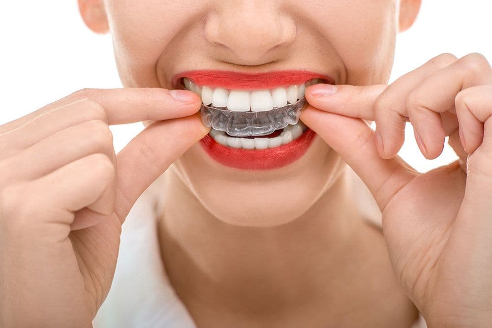 Another patient photo from a Google review at Downtown Dental Clinic